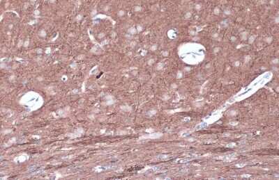 Immunohistochemistry-Paraffin: PKC epsilon [p Ser729] Antibody [NBP3-13312]